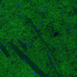SLC6A3/DAT1 Antibody (CL3123), Novus Biologicals:Antibodies:Primary Antibodies
