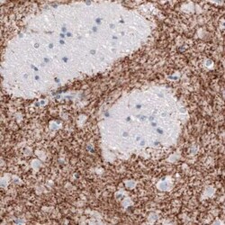 SLC6A3/DAT1 Antibody (CL3123), Novus Biologicals:Antibodies:Primary Antibodies