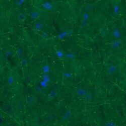 SLC6A3/DAT1 Antibody (CL3123), Novus Biologicals:Antibodies:Primary Antibodies