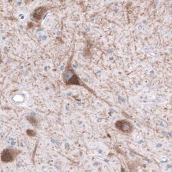 SLC6A3/DAT1 Antibody (CL3123), Novus Biologicals:Antibodies:Primary Antibodies