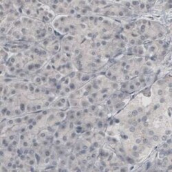 SLC6A3/DAT1 Antibody (CL3123), Novus Biologicals:Antibodies:Primary Antibodies