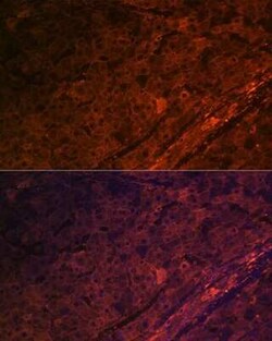SLC6A4/5-HTTLPR/Serotonin transporter Rabbit anti-Human, Rat, Clone: 5T7M2,