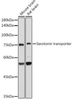 SLC6A4/5-HTTLPR/Serotonin transporter Rabbit anti-Human, Rat, Clone: 5T7M2,