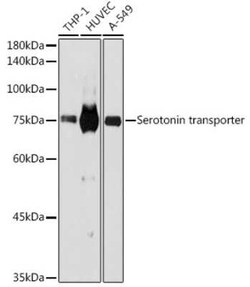 SLC6A4/5-HTTLPR/Serotonin transporter Rabbit anti-Human, Rat, Clone: 5T7M2,
