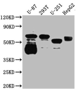SLC6A4/5-HTTLPR/Serotonin transporter Antibody (9G3), Novus Biologicals 100 &mu;g | Buy Online | Novus Biologicals | Fisher Scientific