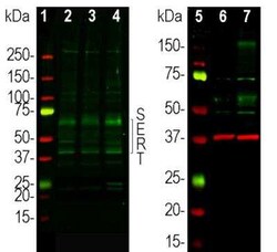 SLC6A4/5-HTTLPR/Serotonin transporter Antibody, Novus Biologicals 50 &mu;g;