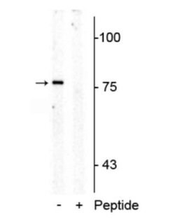 SLC6A4/5-HTTLPR/Serotonin transporter, p Thr276 Antibody, Novus Biologicals 100 &mu;L | Buy Online | Novus Biologicals | Fisher Scientific