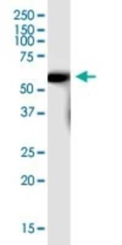 SLC7A7 Antibody, Novus Biologicals 0.05 mg, Unconjugated:Antibodies, Polyclonal