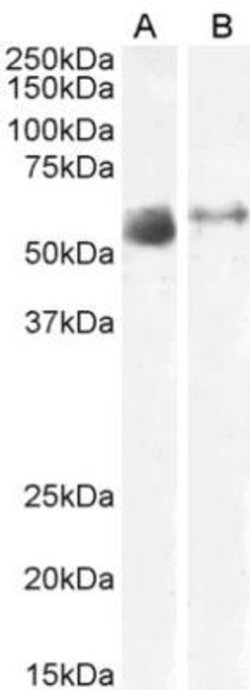 SLC7A7 Antibody, Novus Biologicals 100 &mu;g | Buy Online | Novus Biologicals | Fisher Scientific