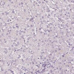 SLC7A8 Antibody, Novus Biologicals 25 &mu;L, Unconjugated:Antibodies, Polyclonal