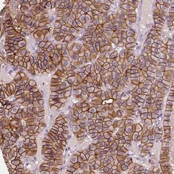 SLC7A8 Antibody, Novus Biologicals 25 &mu;L, Unconjugated:Antibodies, Polyclonal