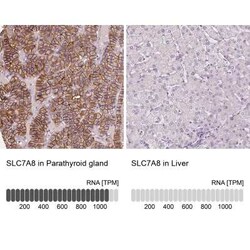 SLC7A8 Antibody, Novus Biologicals 25 &mu;L, Unconjugated:Antibodies, Polyclonal