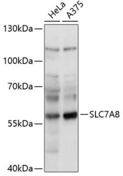 SLC7A8 Antibody - Azide and BSA Free, Novus Biologicals 0.02 mL; Unconjugated:Antibodies,