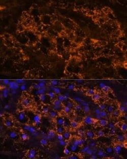 SLC7A9 Antibody - Azide and BSA Free, Novus Biologicals:Antibodies:Primary