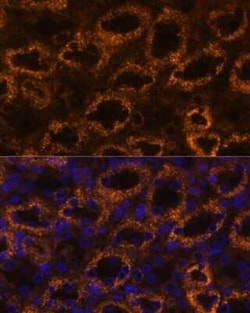 SLC7A9 Antibody - Azide and BSA Free, Novus Biologicals:Antibodies:Primary