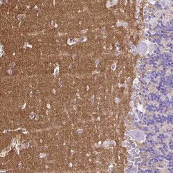 SLC8A2 Antibody, Novus Biologicals 25 &mu;L | Buy Online | Novus Biologicals | Fisher Scientific