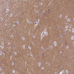 SLC8A2 Antibody, Novus Biologicals 0.1 mL, Unconjugated:Antibodies, Polyclonal