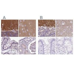 SLC8A2 Antibody, Novus Biologicals 0.1 mL, Unconjugated:Antibodies, Polyclonal