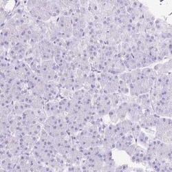 SLC8A2 Antibody, Novus Biologicals 25 &mu;L | Buy Online | Novus Biologicals | Fisher Scientific