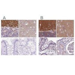 SLC8A2 Antibody, Novus Biologicals 25 &mu;L | Buy Online | Novus Biologicals | Fisher Scientific