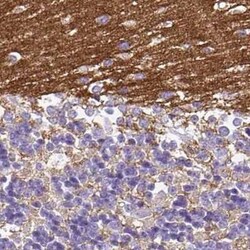 SLC8A2 Antibody, Novus Biologicals 25 &mu;L | Buy Online | Novus Biologicals | Fisher Scientific