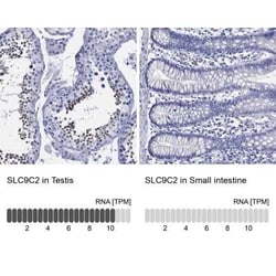SLC9A11 Rabbit anti-Human, Polyclonal, Novus Biologicals:Antibodies:Primary