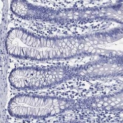 SLC9A11 Rabbit anti-Human, Polyclonal, Novus Biologicals:Antibodies:Primary