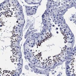 SLC9A11 Rabbit anti-Human, Polyclonal, Novus Biologicals:Antibodies:Primary