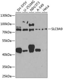 SLC9A9 Antibody - BSA Free, Novus Biologicals:Antibodies:Primary Antibodies