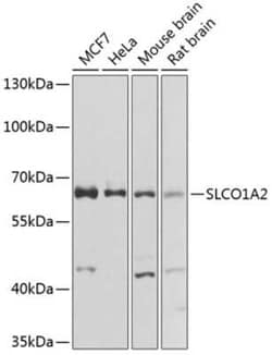 SLCO1A2 Antibody - Azide and BSA Free, Novus Biologicals 0.1 mL; Unconjugated:Antibodies,