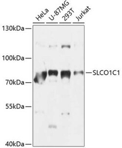 SLCO1C1 Antibody - BSA Free, Novus Biologicals 0.02 mL, Unconjugated:Antibodies,