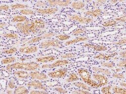 SLCO4C1 Antibody, Novus Biologicals 50 &mu;g; Unconjugated:Antibodies,