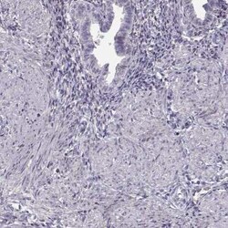 SLCO6A1 Antibody, Novus Biologicals 25 &mu;L, Unconjugated:Antibodies,