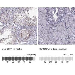 SLCO6A1 Antibody, Novus Biologicals 25 &mu;L, Unconjugated:Antibodies,