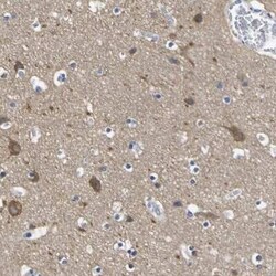 SLITRK1 Antibody, Novus Biologicals 0.1 mL; Unconjugated:Antibodies, Polyclonal