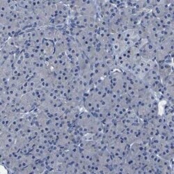 SLITRK1 Antibody, Novus Biologicals 0.1 mL; Unconjugated:Antibodies, Polyclonal