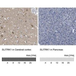 SLITRK1 Antibody, Novus Biologicals 0.1 mL; Unconjugated:Antibodies, Polyclonal