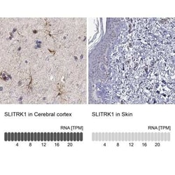 SLITRK1 Rabbit anti-Human, Polyclonal, Novus Biologicals:Antibodies:Primary