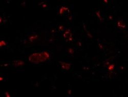 SLITRK2 Antibody - BSA Free, Novus Biologicals 0.1 mg; Unconjugated:Antibodies,