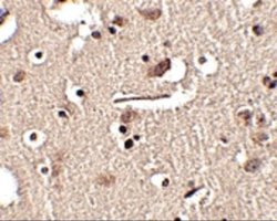 SLITRK2 Antibody - BSA Free, Novus Biologicals 0.1 mg; Unconjugated:Antibodies,
