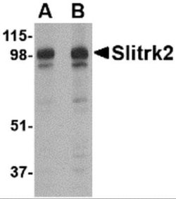 SLITRK2 Antibody - BSA Free, Novus Biologicals 0.1 mg | Buy Online | Novus Biologicals | Fisher Scientific