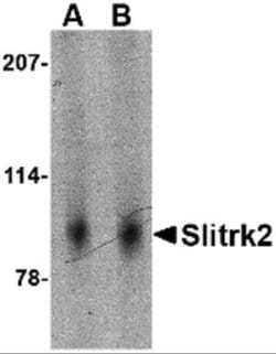 SLITRK2 Antibody - BSA Free, Novus Biologicals 0.1 mg; Unconjugated:Antibodies,
