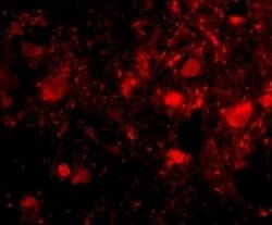 SLITRK3 Antibody - BSA Free, Novus Biologicals 0.1 mg; Unconjugated:Antibodies,