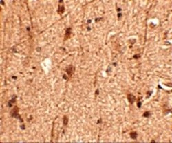 SLITRK3 Antibody - BSA Free, Novus Biologicals 0.1 mg; Unconjugated:Antibodies,