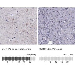 SLITRK3 Antibody, Novus Biologicals:Antibodies:Primary Antibodies