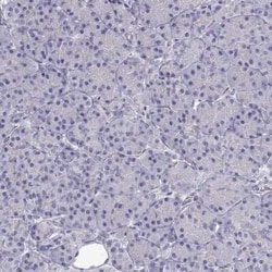 SLITRK3 Antibody, Novus Biologicals:Antibodies:Primary Antibodies