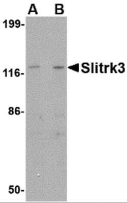 SLITRK3 Antibody - BSA Free, Novus Biologicals 0.1 mg; Unconjugated:Antibodies,