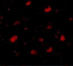 SLITRK5 Antibody - BSA Free, Novus Biologicals 0.1 mg; Unconjugated:Antibodies,