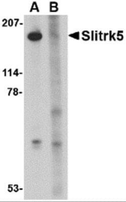 SLITRK5 Antibody - BSA Free, Novus Biologicals 0.1 mg; Unconjugated:Antibodies,