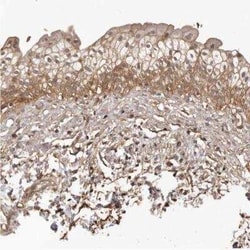 SLITRK6 Antibody, Novus Biologicals:Antibodies:Primary Antibodies